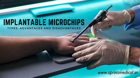 can you implant a rfid chip in humans|Microchips in humans: consumer.